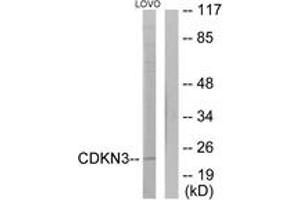 Western blot analysis of extracts from LOVO cells, using CDKN3 Antibody. (CDKN3 anticorps  (AA 31-80))