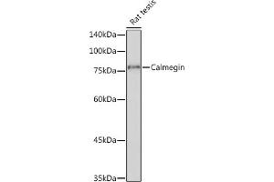 Western blot analysis of extracts of Rat testis, using Calmegin Rabbit mAb (ABIN7266025) at 1:1000 dilution. (Calmegin anticorps)