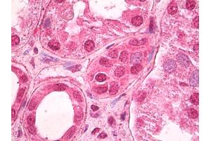 Anti-TCF7L2 antibody IHC of human kidney.