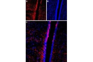 Expression of TRPC4 in rat brain - Immunohistochemical staining of rat third ventricle region using Anti-TRPC4 (extracellular) Antibody (ABIN7043822, ABIN7044067 and ABIN7044068).