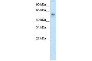 WB Suggested Anti-BTBD3 Antibody Titration:  2. (BTBD3 anticorps  (C-Term))