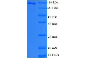SDS-PAGE (SDS) image for Holliday Junction Recognition Protein (HJURP) (AA 1-748), (full length) protein (His-SUMO Tag) (ABIN5709663)