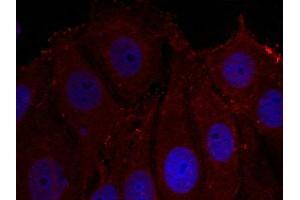 Immunofluorescence staining of methanol-fixed Hela cells using a-Synuclein(Phospho-Tyr133) Antibody.