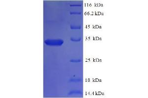 SDS-PAGE (SDS) image for Kinesin Family Member 1C (KIF1C) (AA 1-272) protein (His tag) (ABIN5713582)
