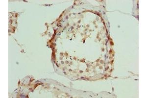 Immunohistochemistry of paraffin-embedded human testis tissue using ABIN7166405 at dilution of 1:100 (ARMT1 (AA 2-250) anticorps)