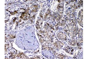IHC analysis of Vitamin D Binding protein using anti-Vitamin D Binding protein antibody .