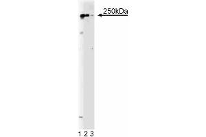 Western blot analysis of RPTPbeta on a Jurkat cell lysate.