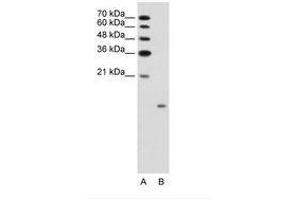 Image no. 1 for anti-Glucagon (GCG) (AA 41-90) antibody (ABIN203495) (Glucagon anticorps  (AA 41-90))