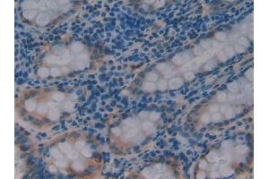 DAB staining on IHC-P; Samples: Human Rectum Tissue (PDK1 anticorps  (AA 233-430))