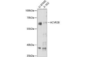 Western blot analysis of extracts of various cell lines, using B antibody (ABIN7265414) at 1:3000 dilution. (ACVR2B anticorps  (AA 50-150))