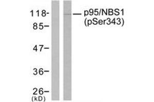 Western blot analysis of extracts from Jurkat cells, using p95/NBS1 (Phospho-Ser343) Antibody. (Nibrin anticorps  (pSer343))