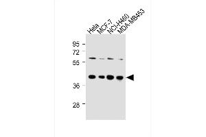 All lanes : Anti-LTM4B-4 Antibody at 1:250 dilution Lane 1: Hela whole cell lysates Lane 2: MCF-7 whole cell lysates Lane 3: NCI- whole cell lysates Lane 4: MDA-M whole cell lysates Lysates/proteins at 20 μg per lane. (LAPTM4B anticorps  (AA 195-209))