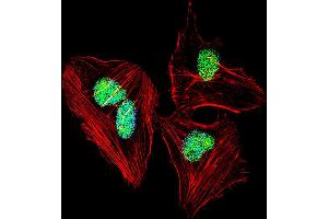 Fluorescent confocal image of Hela cell stained with NFIA Antibody . (NFIA anticorps  (C-Term))