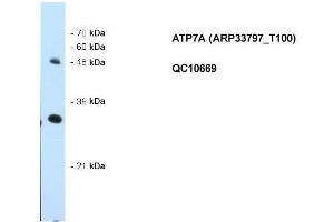 WB Suggested Anti-ATP7A Antibody Titration: 0. (ATP7A anticorps  (N-Term))