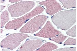 TRPA1 antibody  ABIN1104836 (5 ug/ml) was used in IHC to stain formalin-fixed, paraffin-embedded human skeletal muscle, followed by biotinylated goat anti-rabbit IgG secondary antibody, alkaline phosphatase-streptavidin and chromogen.