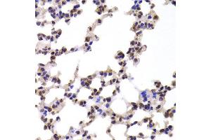 Immunohistochemistry of paraffin-embedded Mouse lung using CMPK1 antibody at dilution of 1:100 (x400 lens). (Cytidine Monophosphate (UMP-CMP) Kinase 1, Cytosolic (CMPK1) anticorps)