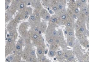 Detection of ARPC4 in Human Liver Tissue using Polyclonal Antibody to Actin Related Protein 2/3 Complex Subunit 4 (ARPC4)