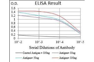 Black line: Control Antigen (100 ng), Purple line: Antigen(10 ng), Blue line: Antigen (50 ng), Red line: Antigen (100 ng), (PAPLN anticorps  (AA 766-870))