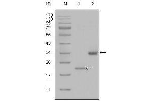 Western Blot showing LPA antibody used against truncated LPA-His recombinant protein (1) and truncated Trx-LPA (aa4330-4521) recombinant protein (2). (LPA anticorps)
