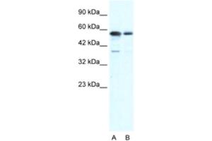 Western Blotting (WB) image for anti-X-Ray Repair Complementing Defective Repair in Chinese Hamster Cells 6 (XRCC6) antibody (ABIN2460867) (XRCC6 anticorps)