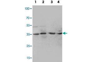 Western blot analysis of tissue lysates with MTA1 polyclonal antibody . (MTA1 anticorps  (C-Term))