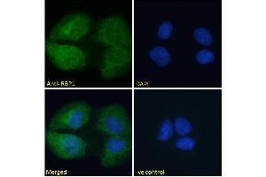 ABIN185365 Immunofluorescence analysis of paraformaldehyde fixed U2OS cells, permeabilized with 0.