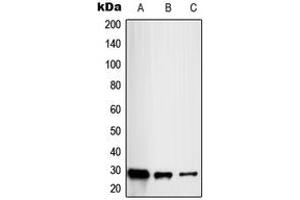 Western blot analysis of RAB20 expression in HL60 (A), HeLa (B), HuvEc (C) whole cell lysates. (RAB20 anticorps  (Center))
