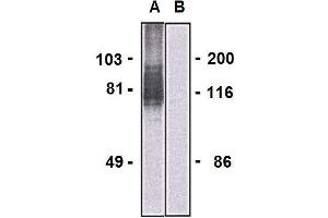 Western blotting analysis of LARGE1 in HEK293-LARGE1 transfectants (A) and HEK293 cells (B) using mouse monoclonal antibody (clone LARGE-02). (LARGE1 (AA 35-142) anticorps)