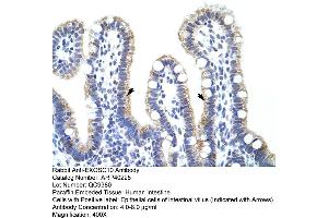 Rabbit Anti-EXOSC10 Antibody  Paraffin Embedded Tissue: Human Intestine Cellular Data: Epithelial cells of intestinal villas Antibody Concentration: 4. (EXOSC10 anticorps  (C-Term))