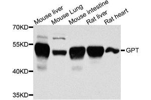 Western blot analysis of extracts of various cell lines, using GPT antibody. (ALT anticorps  (AA 1-190))