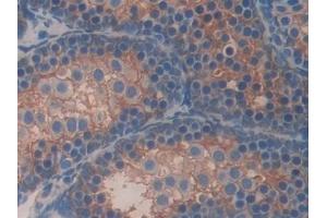 Detection of CBG in Mouse Testis Tissue using Polyclonal Antibody to Corticosteroid Binding Globulin (CBG)