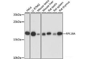 Western blot analysis of extracts of various cell lines using RPL18A Polyclonal Antibody at dilution of 1:1000. (RPL18A anticorps)