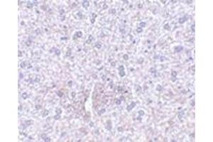 Immunohistochemistry of TEM7 in mouse liver tissue with this product at 2. (PLXDC1 anticorps  (Center))