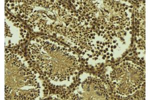ABIN6277431 at 1/100 staining Mouse testis tissue by IHC-P. (RAD50 anticorps  (Internal Region))