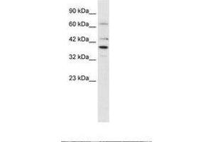 Image no. 2 for anti-POU Domain, Class 4, Transcription Factor 3 (POU4F3) (AA 211-260) antibody (ABIN202275) (POU4F3 anticorps  (AA 211-260))