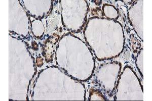 Image no. 1 for anti-Destrin (Actin Depolymerizing Factor) (DSTN) antibody (ABIN1497910) (Destrin anticorps)