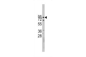 Western blot analysis of CDH10 Antibody in CEM cell line lysates (35ug/lane)