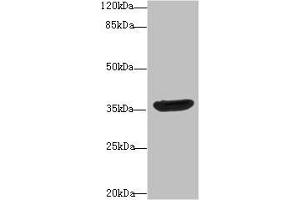 Western blot All lanes: DNAJB2 antibody at 10 μg/mL + A431 whole cell lysate Secondary Goat polyclonal to rabbit IgG at 1/10000 dilution Predicted band size: 36, 31 kDa Observed band size: 36 kDa