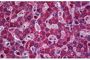 Human Liver: Formalin-Fixed, Paraffin-Embedded (FFPE) (PIM1 anticorps  (AA 1-314))