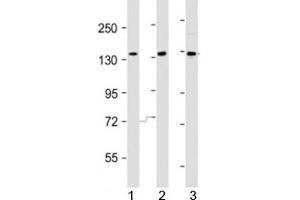 Western blot testing of AATK antibody at 1:2000 dilution. (AATK anticorps  (AA 46-74))