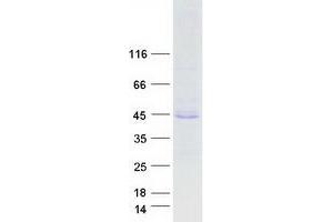 Validation with Western Blot
