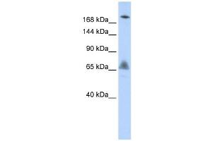 VPS8 antibody used at 1 ug/ml to detect target protein. (VPS8 anticorps)