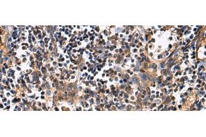 Immunohistochemistry of paraffin-embedded Human tonsil tissue using ECM1 Polyclonal Antibody at dilution of 1:25(x200) (ECM1 anticorps)