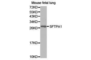 Western Blotting (WB) image for anti-Surfactant Protein A1 (SFTPA1) antibody (ABIN1874759) (Surfactant Protein A1 anticorps)
