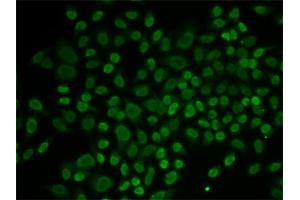 Immunofluorescence analysis of MCF-7 cells using RAD54L2 antibody.