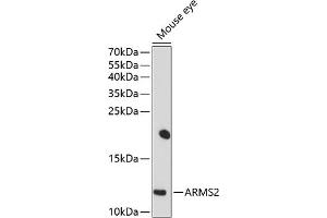 Western blot analysis of extracts of mouse eye, using  antibody (ABIN6129951, ABIN6137123, ABIN6137124 and ABIN6214318) at 1:1000 dilution. (ARMS2 anticorps  (AA 1-107))