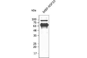 Western Blotting (WB) image for anti-SARS-CoV-2 Non-Structural Protein 10 (NSP10) antibody (ABIN7273003) (SARS-CoV-2 NSP10 anticorps)