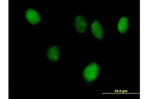 Immunofluorescence of purified MaxPab antibody to STAT6 on HeLa cell. (STAT6 anticorps  (AA 1-847))