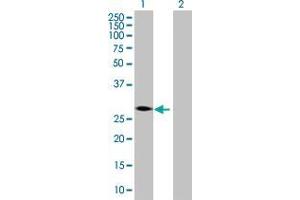 Lane 1: ZBTB32 transfected lysate ( 33. (ZBTB32 293T Cell Transient Overexpression Lysate(Denatured))