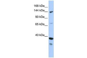 DHX37 antibody used at 1 ug/ml to detect target protein. (DHX37 anticorps)